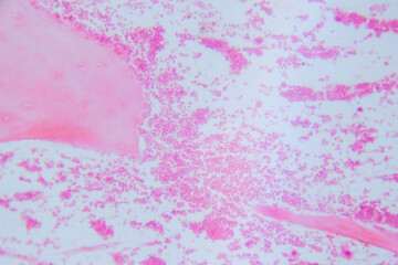 Decalcified compact bone section showing pink-stained trabecular patterns