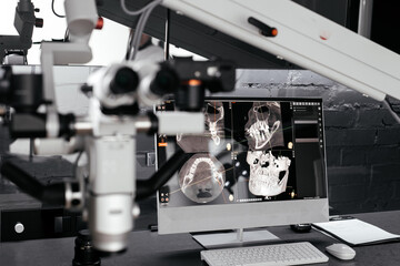 Microscope in dentistry on the background of the screen with images of the jaw. Concept of modern...