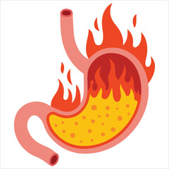 Burning stomach acid reflux isolated vector illustration on white background
