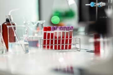 Scientist conducts a blood test in sterile laboratory setting, carefully placing a blood sample on glass slide for detailed examination to support diagnostics, healthcare medical breakthroughs