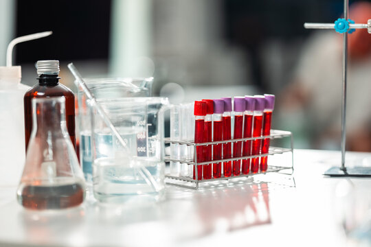Scientist conducts a blood test in sterile laboratory setting, carefully placing a blood sample on glass slide for detailed examination to support diagnostics, healthcare medical breakthroughs