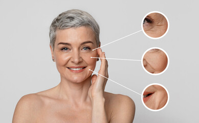 Aged Skin Care. Creative collage of beautiful mature woman's portrait with zoomed wrinkles zones...