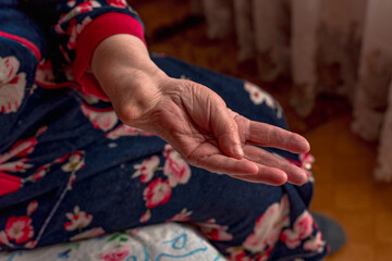 An elderly woman with a crooked arm with a fracture, an improperly fused fracture of the bones of the hands. Grandmother's injury.