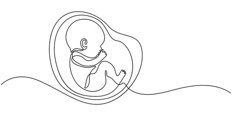 Baby embryo in womb one line drawing. Cute unborn fetus baby on mother womb isolated on white background, Baby embryo in womb in one continuous line drawing. Healthy pregnancy and premature symbol.