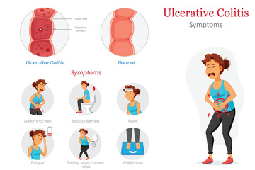 Healthy vs Ulcerative Colitis Intestine Diagram Showing Symptoms