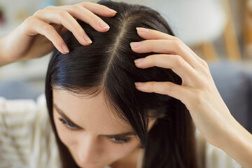 Obraz premium Woman checking head skin, damaged dry hair ends, dissatisfied by hairstyle, stressed girl worried by beauty problem, losing hair in need of treatment, trichology diagnosis, scalp disorder, diseases