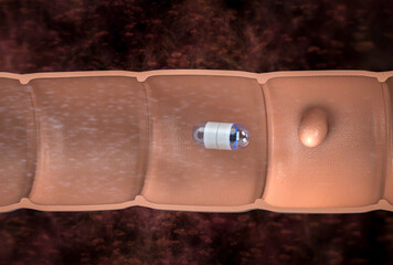 Capsule endoscopy in intestine cutaway