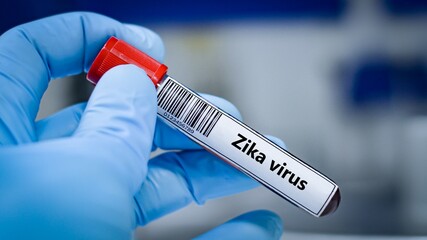 Fototapeta premium blood sample tube for zika virus test analysis.