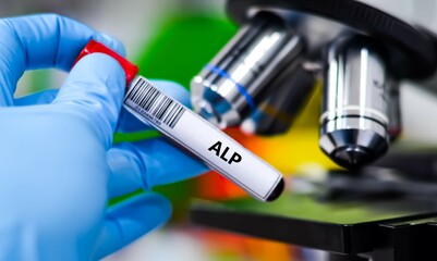 Blood sample tube for alkaline phosphatase (ALP) test analysis. 