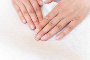 Damaged fingernails from gel polish. Hand care. Nail health. Free space.