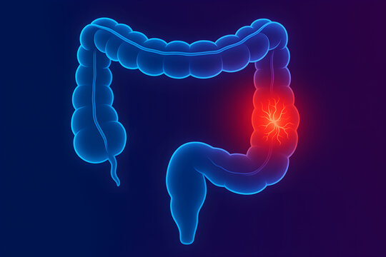 colorectal cancer,  bowel cancer, colon cancer, rectal cancer, tumor, organ, body, human, doctor, hospital, gastroenterologist, proctologist