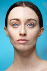 Split Face Image Showing Skin Before-And-After Texture Changes..