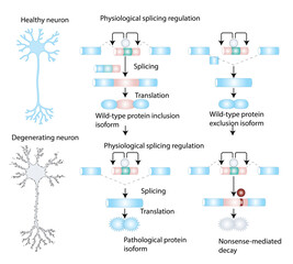 Alternative Splicing Regulation in Healthy vs. Degenerating Neurons 