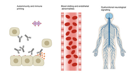 Multi-System Pathophysiology: Autoimmunity, Coagulation & Neurological Dysfunction
