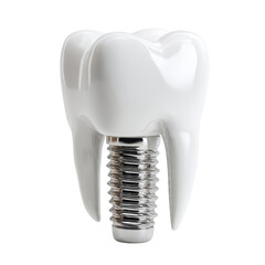 A gleaming white dental implant is displayed against a clean white background, representing modern dentistry and tooth replacement solutions for oral health care.