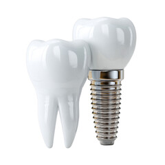 A shiny dental implant stands alongside a natural tooth against a plain white backdrop, demonstrating the restoration process and advanced dental technology today.