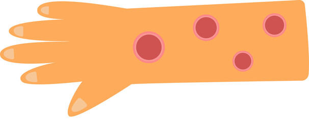 leishmania disease concept. sandfly carrier of leishmania disease