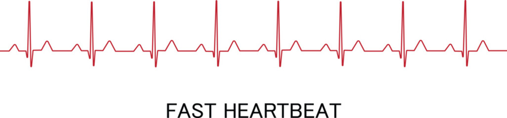 Fast Heartbeat vector illustration red colour Graphs of a fast heartbeat isolated on a white background.