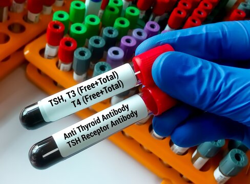 Blood sample for Thyroid panel test including TSH, FT4, FT3, T3, T4, Anti TPO, Anti TG, TR-Ab
