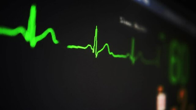 flatline ekg heart monitoring motion design vfx emergency hospital design.