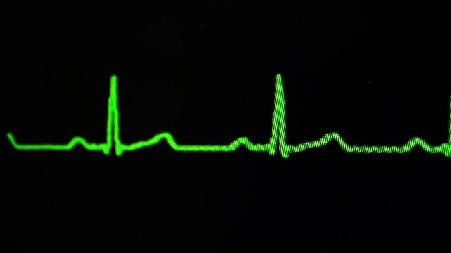 flatline ekg heart monitoring motion design vfx emergency hospital design.