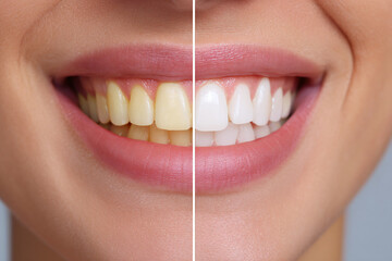 Close-Up of a Womans Joyful Smile