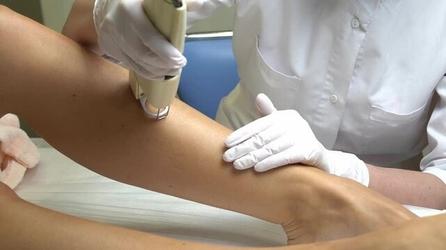 Laser hair removal of legs close-up. Natural natural process of laser hair removal of legs with Alexandrite laser with flashes.