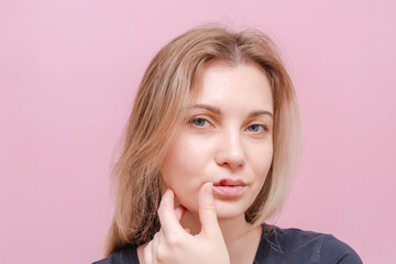 Young woman with virus herpes touching lips against pink background. Herpes blisters