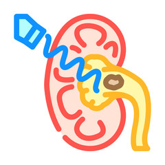 lithotripsy urology color icon vector illustration