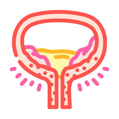 cystitis urology color icon vector illustration