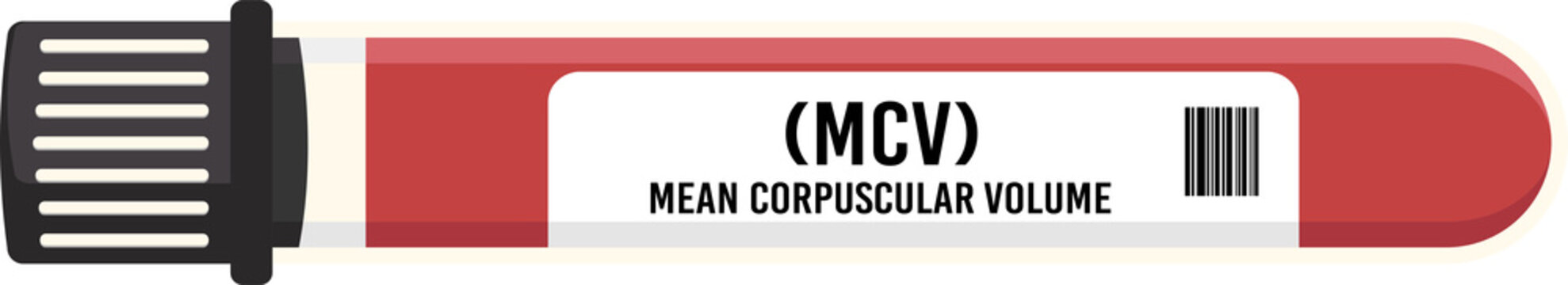 MCV