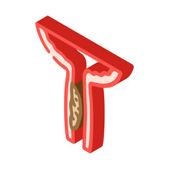 urethral stricture urology isometric icon vector illustration