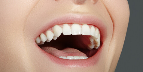 Dental Beauty. Beautiful Macro with perfect White Teeth. Fashion Naturel Lips Make-up. Whitening Tooth, Wellness Treatment