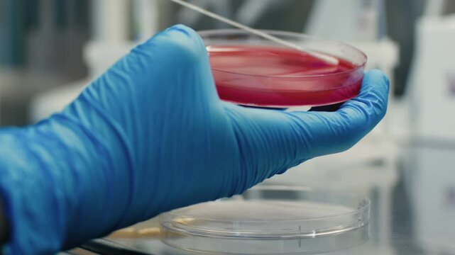 
Bacterial colonies ferment lactose on agar in a microbiology laboratory during an experiment. The concept of studying and diagnosing intestinal infections using specialized culture media.
