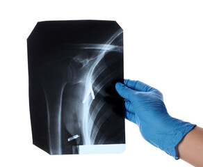 Doctor's hand with x-ray image of shoulder on white background
