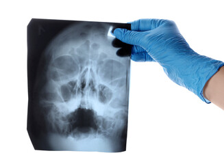 Doctor's hand with x-ray image of skull on white background