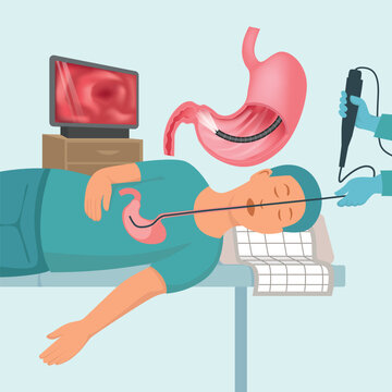 Illustration of a sedated patient undergoing gastroscopy. A flexible endoscope is inserted through the mouth into the stomach, with a monitor showing internal images