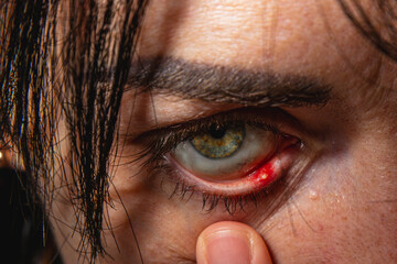 Close-up of an eye showing redness and emotional intensity