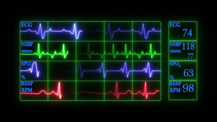 ekg monitor with alpha channel
