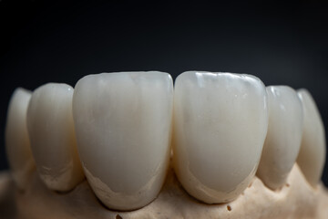 Dental health care. Ceramic zirconium in final version. Close up dental zircon ceramic crowns on black background