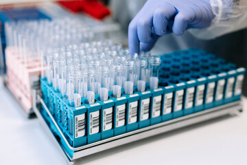 Robotic modern biochemistry laboratory. Lab technician sorting sample containers for microbiological research. Concept automation and precision in clinical testing