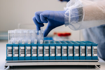 Concept automation and precision in clinical testing. Robotic modern biochemistry laboratory. Lab...
