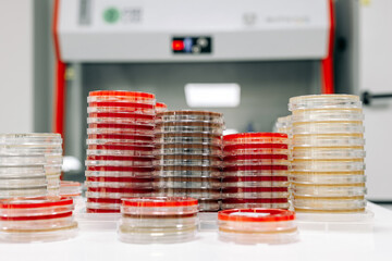 Petri dishes with cultures in the laboratory. A concept that analyzes the growth of microorganisms...