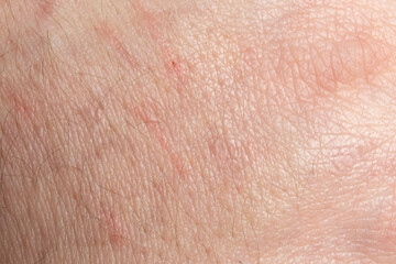 light caucasian skin texture macro