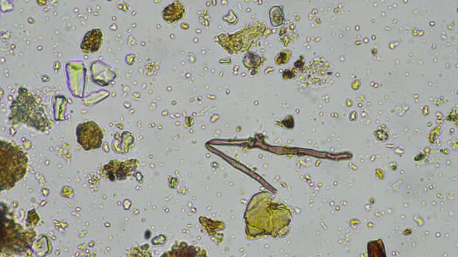 microorganisms and soil biology, with nematodes and fungi under the microscope. in a soil and compost sample