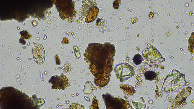 microorganisms and soil biology, with nematodes and fungi under the microscope. in a soil and compost sample