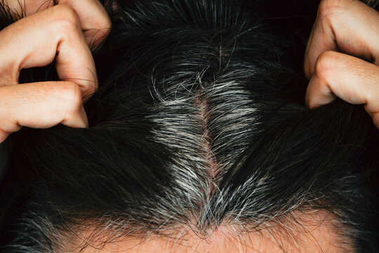 Mature woman with dark hair and visible gray roots. Concept of hormonal hair loss, female health, and aging-related changes