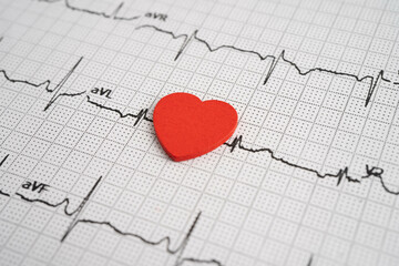 Electrocardiogram ECG heart wave, heart attack, cardiogram report.