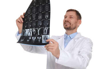 Doctor examining brain MRI scan in clinic on white background