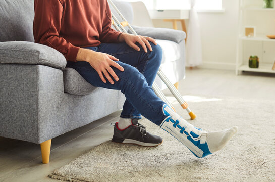 Unrecognizable faceless man with broken leg in plaster cast, posing on comfortable couch in living room, resting after walking, undergoes rehabilitation after accident, has bone fracture